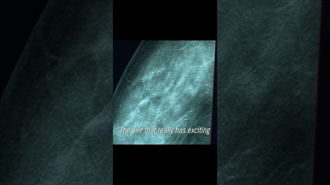 How artificial intelligence is helping us read mammograms.